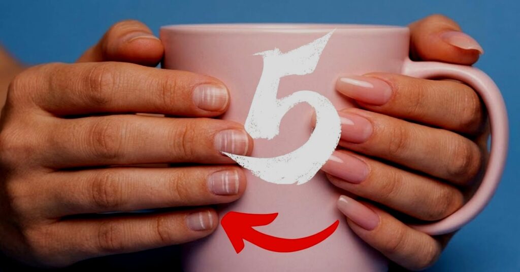 Proibido pelas manicures: 5 hábitos que causam manchas brancas e enfraquecem as unhas
