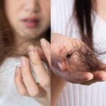 Queda de cabelo no inverno: 5 soluções naturais para fortalecer os fios