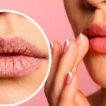 Lábios rachados: soluções acessíveis para revitalizar a boca e combater o ressecamento