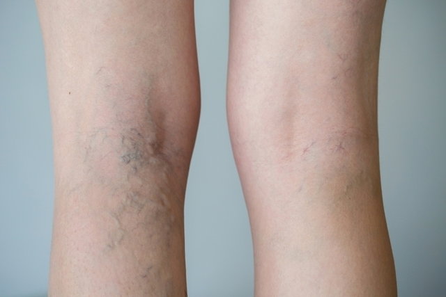 este especialista estão: Varizes e vasinhos; Trombose venosa profunda; Insuficiê