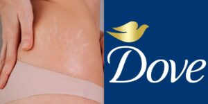 Firmeza para a pele: Sérum concentrado corporal da Dove reduz estrias e cicatrizes