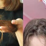 Queda de cabelo: 5 tônicos recomendados por especialista para fortalecer os fios
