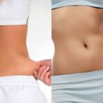 Cintura fina: 3 estratégias além da academia para preparar o corpo antes do verão