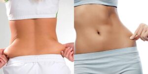 Cintura fina: 3 passos além da academia que mudam o corpo antes do Verão