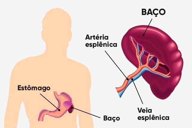Dor no baço: causas, sintomas e o que fazer para cuidar da saúde