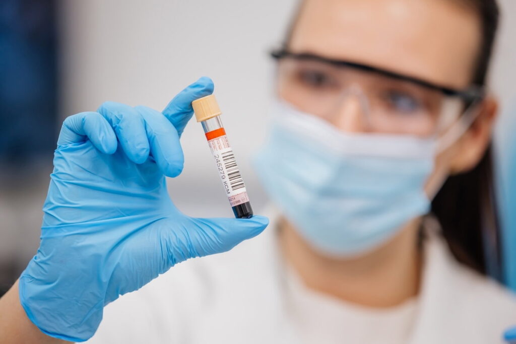 Exame de creatinina: entenda a importância da avaliação da função renal
