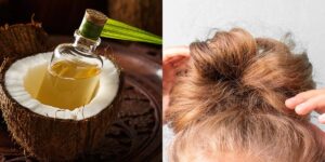 Óleo de coco para acabar com o frizz no cabelo (Reprodução: Montagem TV Foco)
