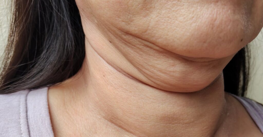 Sem cirurgia: 6 dicas de como disfarçar a papada em casa para deixar o rosto fino