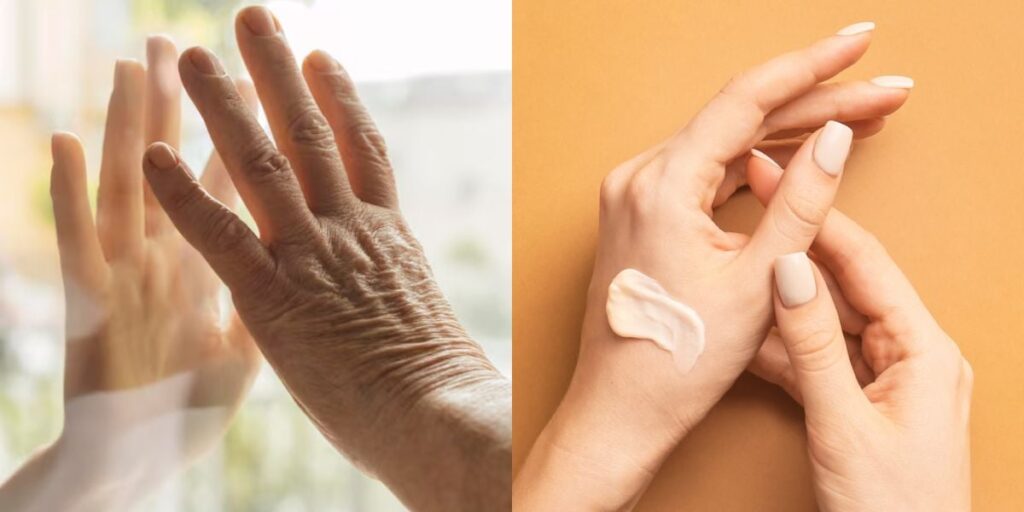 Mãos envelhecem de forma precoce e intensa: Como protegê-las e evitar surgimento de rugas