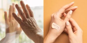 Mãos envelhecem de forma precoce e intensa: Como protegê-las e evitar surgimento de rugas