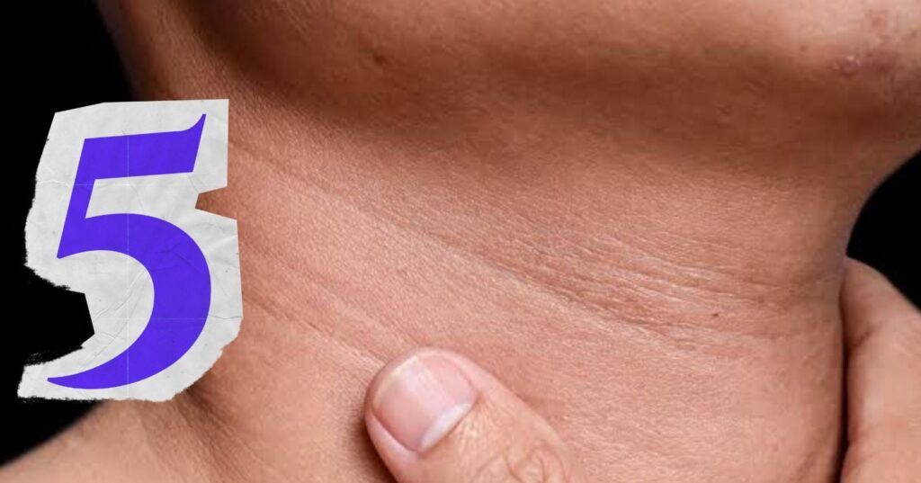Dermatologista revela 5 dicas essenciais para prevenir e suavizar rugas no pescoço