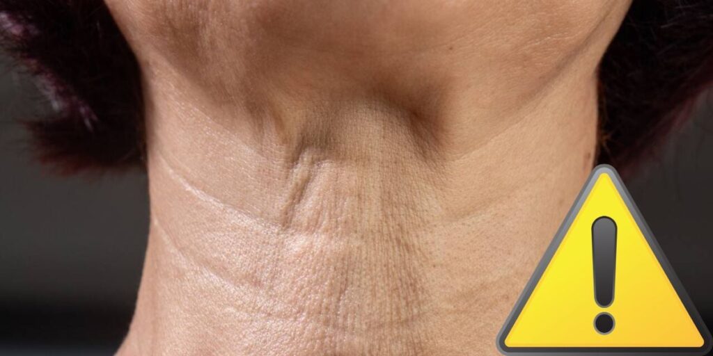 Dermatologista revela estratégias eficazes para combater rugas no pescoço