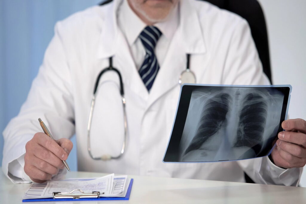 Pneumonia: entenda os riscos, os sintomas e a importância do diagnóstico precoce