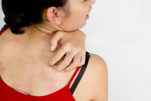 Alergia na pele: entenda as causas, os sintomas e quando buscar ajuda médica