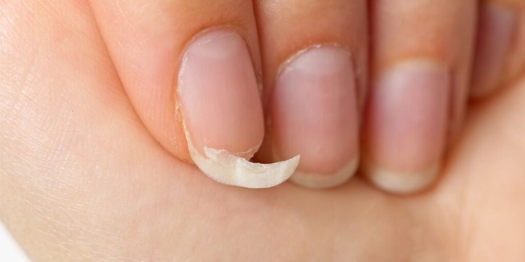 Como proteger as unhas dos danos causados pela rotina diária de lavar louça