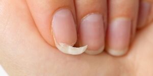 Como proteger as unhas dos danos causados pela rotina diária de lavar louça