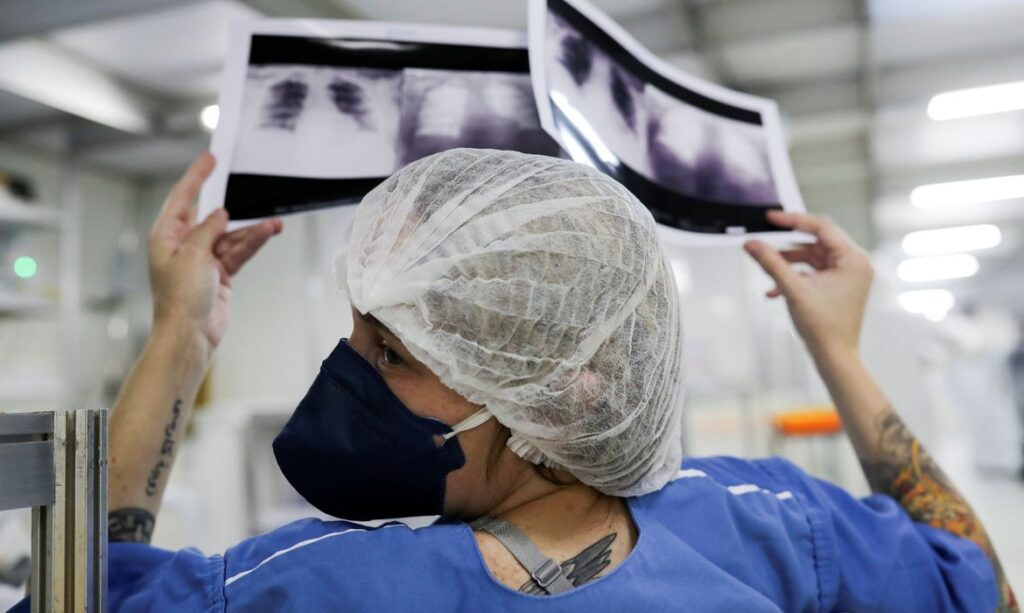 Diagnóstico avançado em 90% dos casos de câncer de pulmão no SUS limita chances de cura