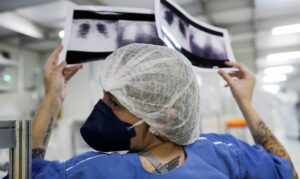 Diagnóstico avançado em 90% dos casos de câncer de pulmão no SUS limita chances de cura