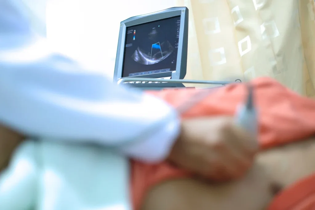 Ecocardiograma: entenda como funciona o exame essencial para a saúde do coração