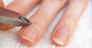 O fim do alicate: Especialistas explicam como cuidar das cutículas para unhas mais saudáveis