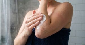 Pele áspera nos cotovelos: entenda por que a hidratação pós-banho é o segredo para a recuperação
