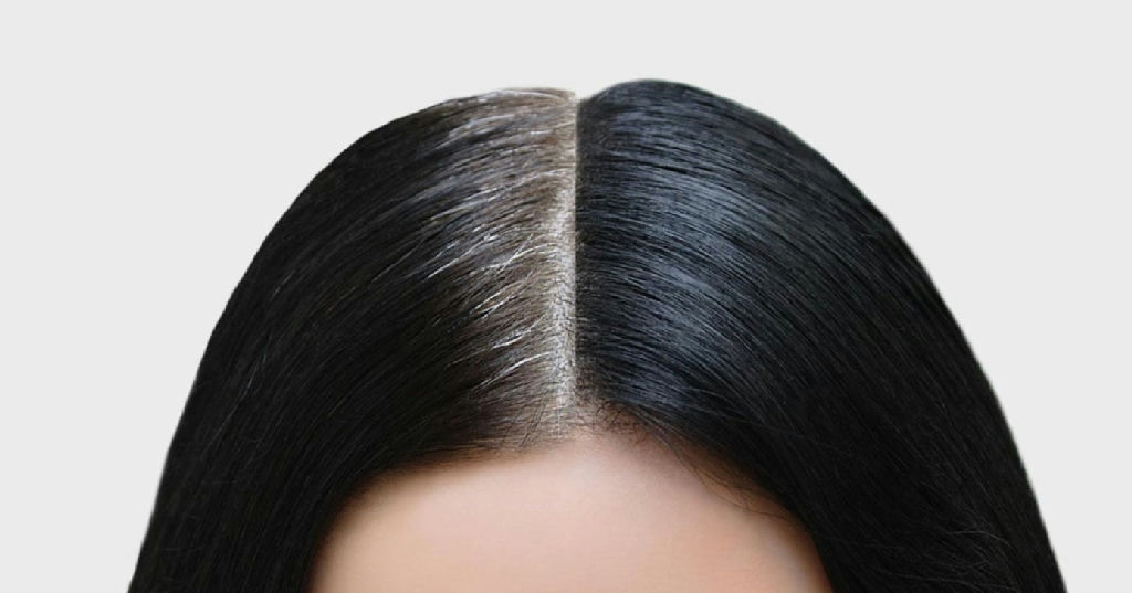 Cabelo branco aos 30 anos: entenda o uso de soluções caseiras para disfarçar fios