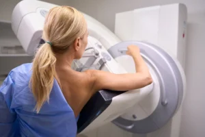 Entenda o que significa a classificação Bi-rads no resultado da sua mamografia