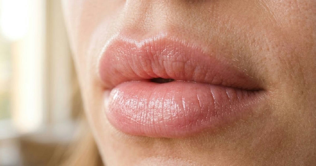 Lábios rosados naturalmente: conheça cuidados caseiros com cúrcuma, mel e beterraba