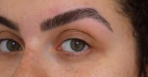 Minoxidil para sobrancelhas: entenda o uso do produto para preencher falhas