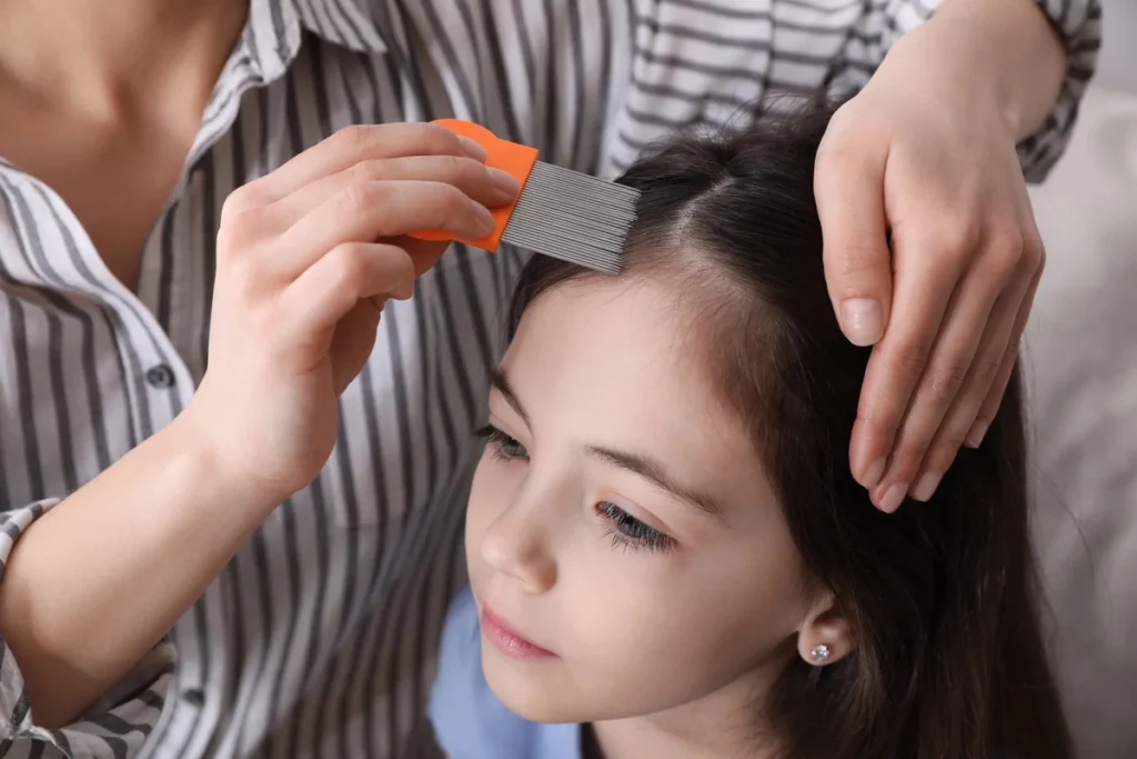 Pediculose: entenda como o piolho se transmite e as formas eficazes de tratamento
