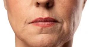 Três cosméticos coreanos que ajudam a reduzir as marcas do bigode chinês