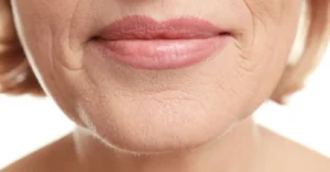 Bigode chinês: entenda como a massagem facial pode suavizar linhas de expressão
