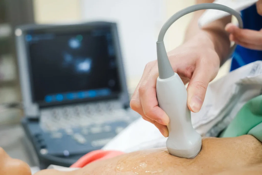 Ecodopplercardiograma: entenda como funciona o exame essencial para a saúde do coração