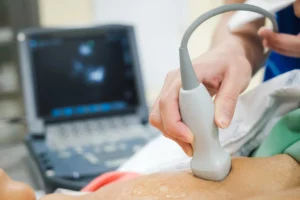 Ecodopplercardiograma: entenda como funciona o exame essencial para a saúde do coração