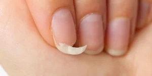 Erro comum na preparação das unhas faz esmalte descascar rapidamente