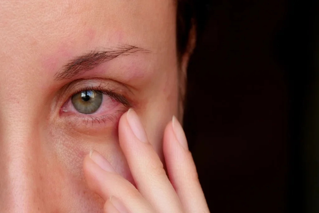 Infecção ocular: entenda os riscos, sintomas e quando buscar ajuda médica especializada