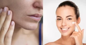 Mistura caseira de creme Nivea e óleo natural combate a pele seca com economia e praticidade