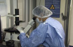 Avanços na ciência: novos casos de remissão do HIV após transplante de células-tronco