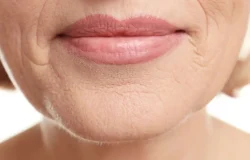 Bigode chinês: entenda como a massagem facial pode suavizar linhas de expressão