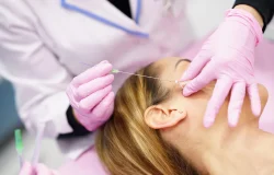 Como funcionam os fios de PDO na estética facial e corporal