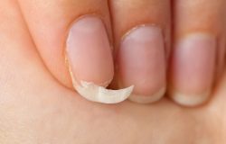 Como proteger as unhas dos danos causados pela rotina diária de lavar louça