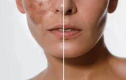 Creme coreano de vitamina C se destaca no cuidado contra manchas na pele