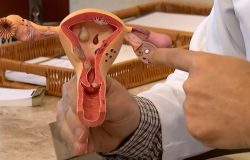 Endometriose recebe investimento de R$ 60 milhões para pesquisas no SUS