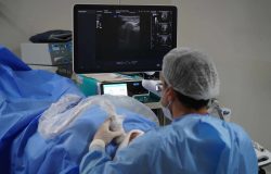 micro-ondas trata nódulo benigno na tireoide em 30 minutos e evita medicação diá