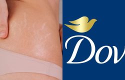 Firmeza para a pele: Sérum concentrado corporal da Dove reduz estrias e cicatrizes