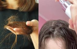 Queda de cabelo: Cabeleireira revela 5 tônicos para fortalecer os fios