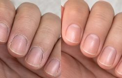 Cutículas ressecadas? Veja como cuidar delas em casa