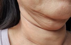 Sem cirurgia: 6 dicas de como disfarçar a papada em casa para deixar o rosto fino