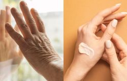 Mãos envelhecem de forma precoce e intensa: Como protegê-las e evitar surgimento de rugas