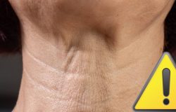 Dermatologista revela estratégias eficazes para combater rugas no pescoço